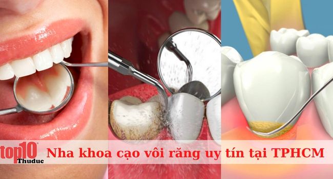 Danh sách các nha khoa cạo vôi răng cực sạch tại TPHCM