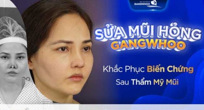 Địa chỉ sửa mũi hỏng uy tín ở Sài Gòn | Nguồn: Bệnh Viện Thẩm Mỹ Gangwhoo