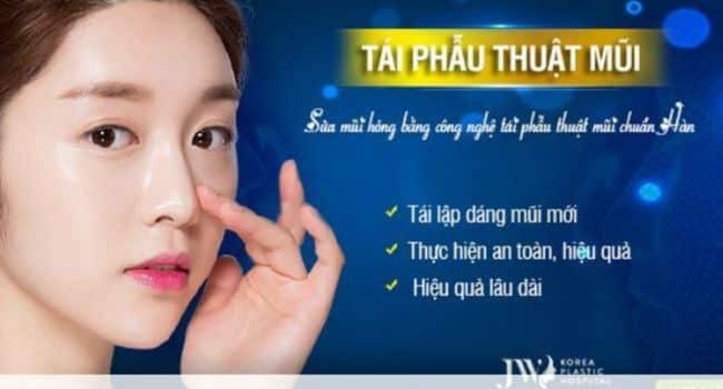 Bệnh viện thẩm mỹ sửa mũi hỏng tại TPHCM | Nguồn: Bệnh viện thẩm mỹ JW Hàn Quốc