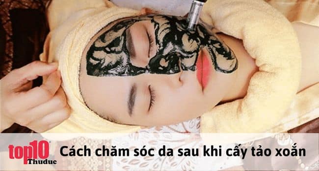 Các nguyên tắc trong cách chăm sóc da sau khi cấy tảo xoắn | Nguồn: Internet